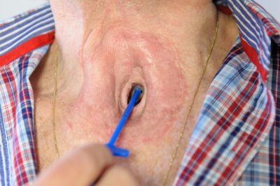 Provox Brush gebruiken | Atos Medical